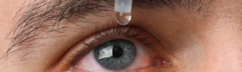 Vigamox Eye Drops