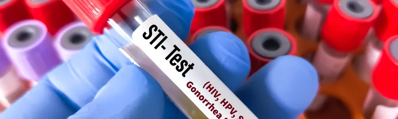 Which Sexually Transmitted Infection Is Caused by Bacteria